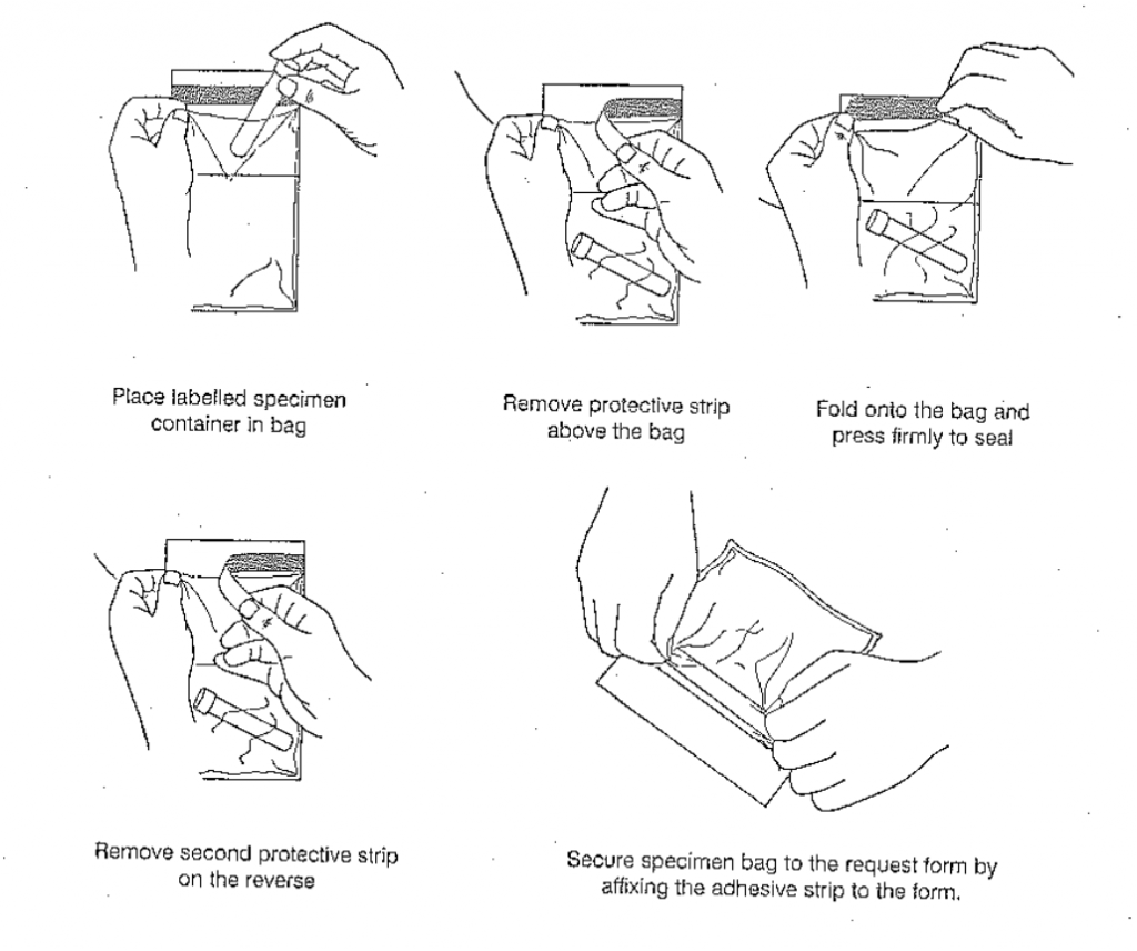 Sending the sample to the laboratory Manchester University NHS Foundation Trust