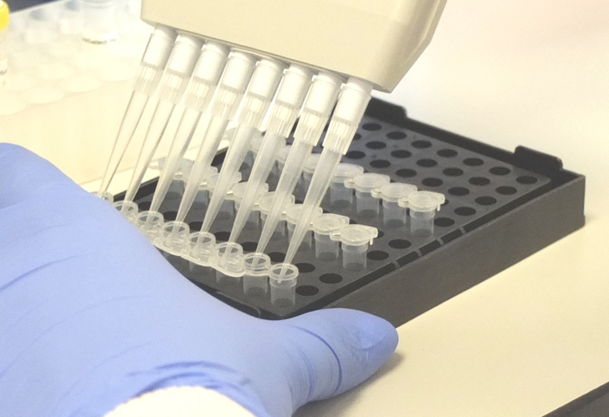 What is an NHS Genomics Laboratory Hub (GLH)? Manchester University