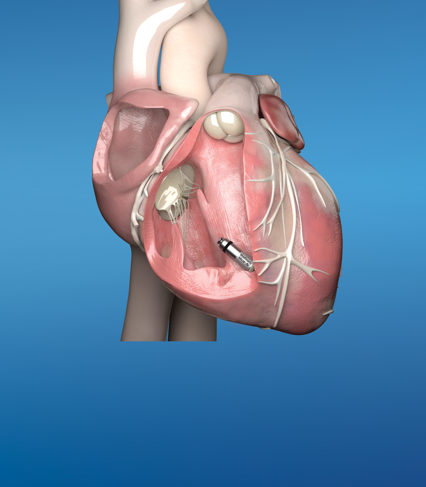 MFT leading the way in innovative cardiac care services - Manchester  University NHS Foundation Trust