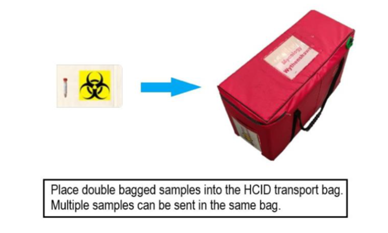 Transport Bag Diagram