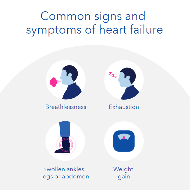 High blood deals pressure symptoms nhs