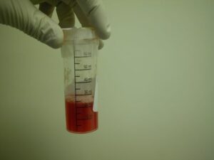 Cytorich Sample collection, pots and special instructions - Manchester ...