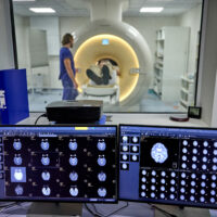 Two computer monitors in the foreground display detailed brain scans, while an MRI scanner is visible blurred in the background of a hospital radiology room.