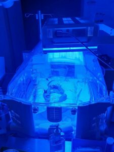 Baby in NICU.